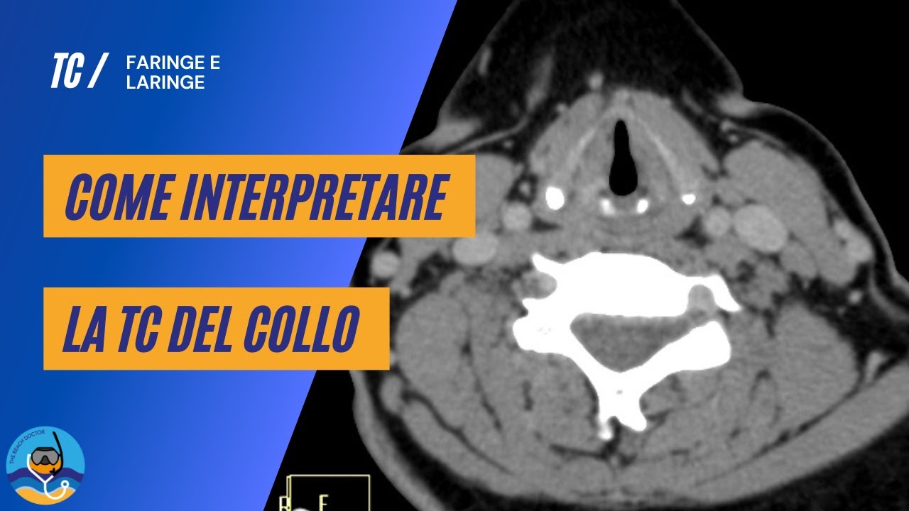 Come interpretare la TC del collo