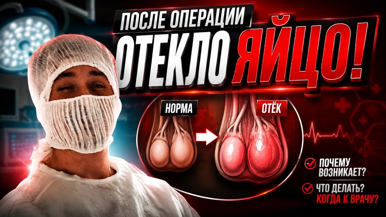 Отёк яичка после операции: Грыжесечение | Паховая грыжа
