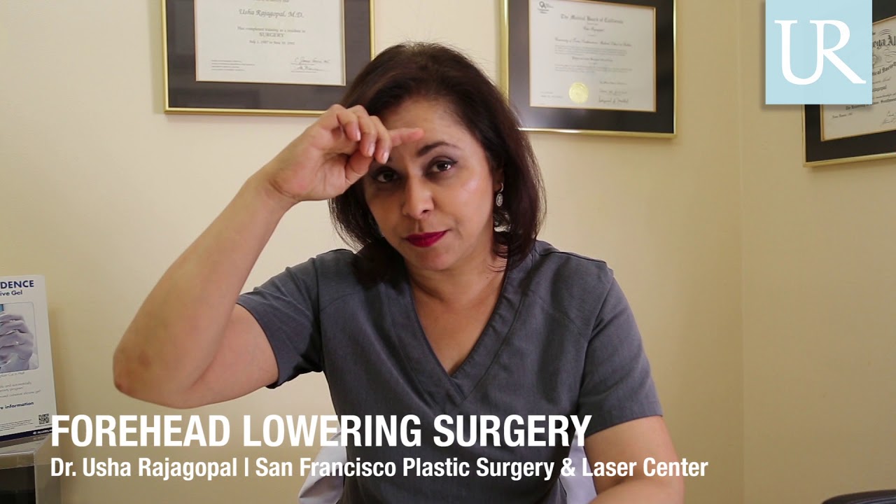 Forehead Reduction (Hairline Lowering) Surgery | Dr. Usha Rajagopal