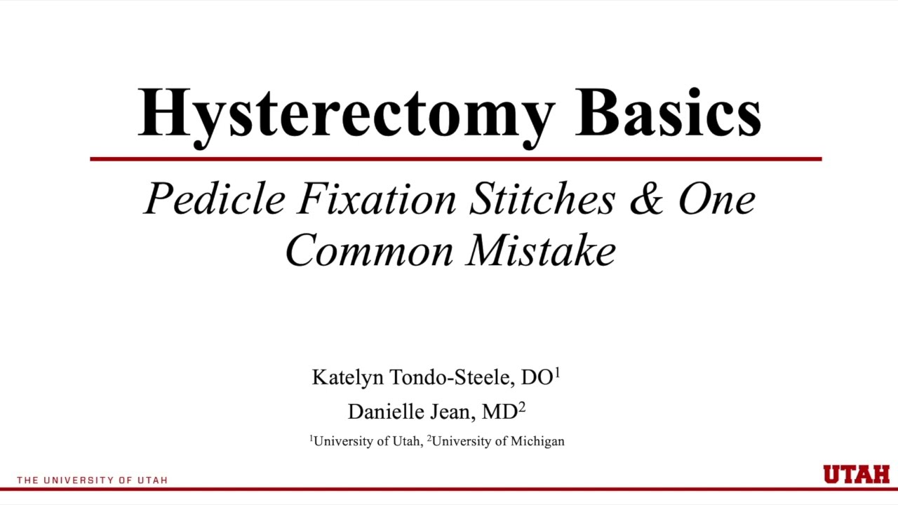 Pedicle Fixation Stitches for Hysterectomy