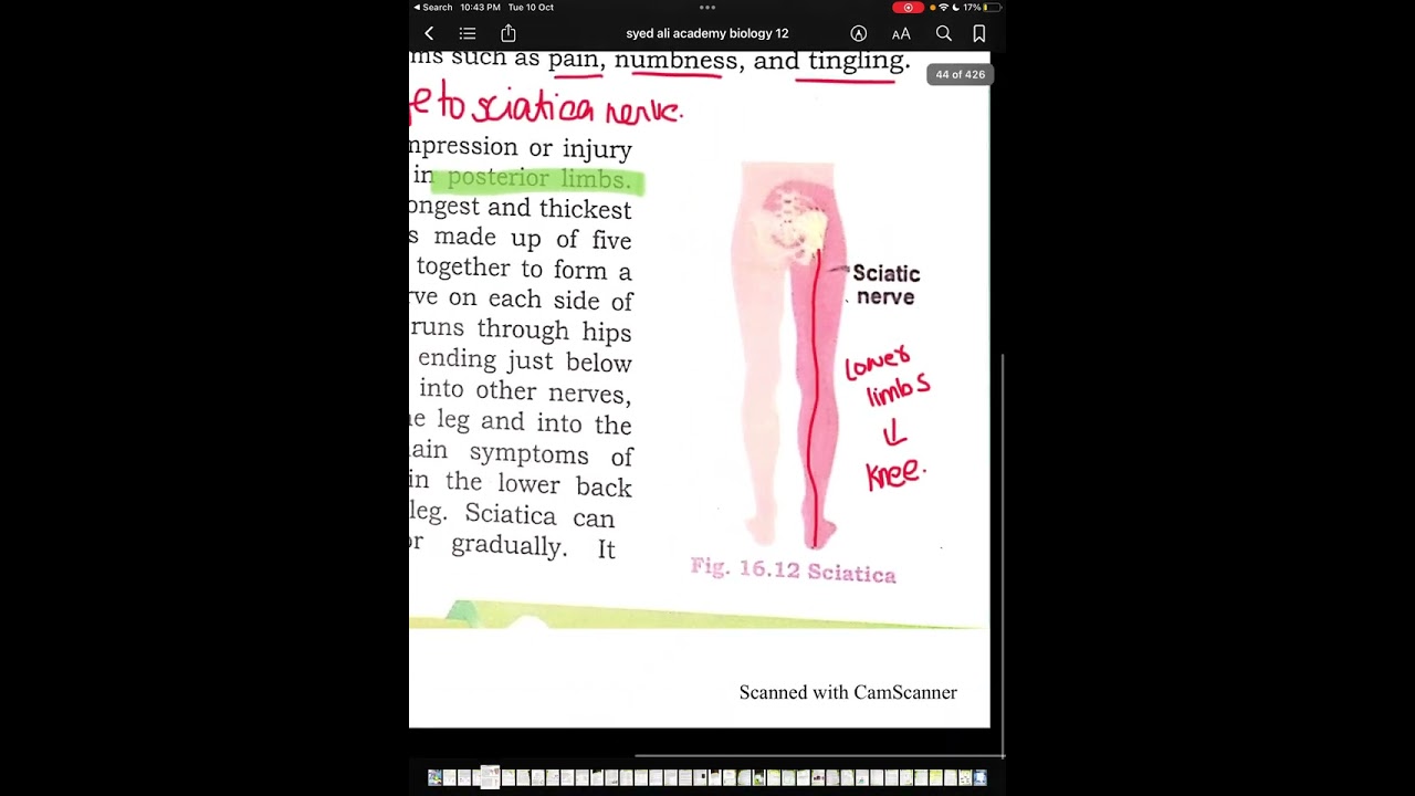 || DISORDERS OF SKELETON || NEW BIOLOGY BOOK || CLASS 12TH || SPONDYLOSIS || #mdcat #zoology