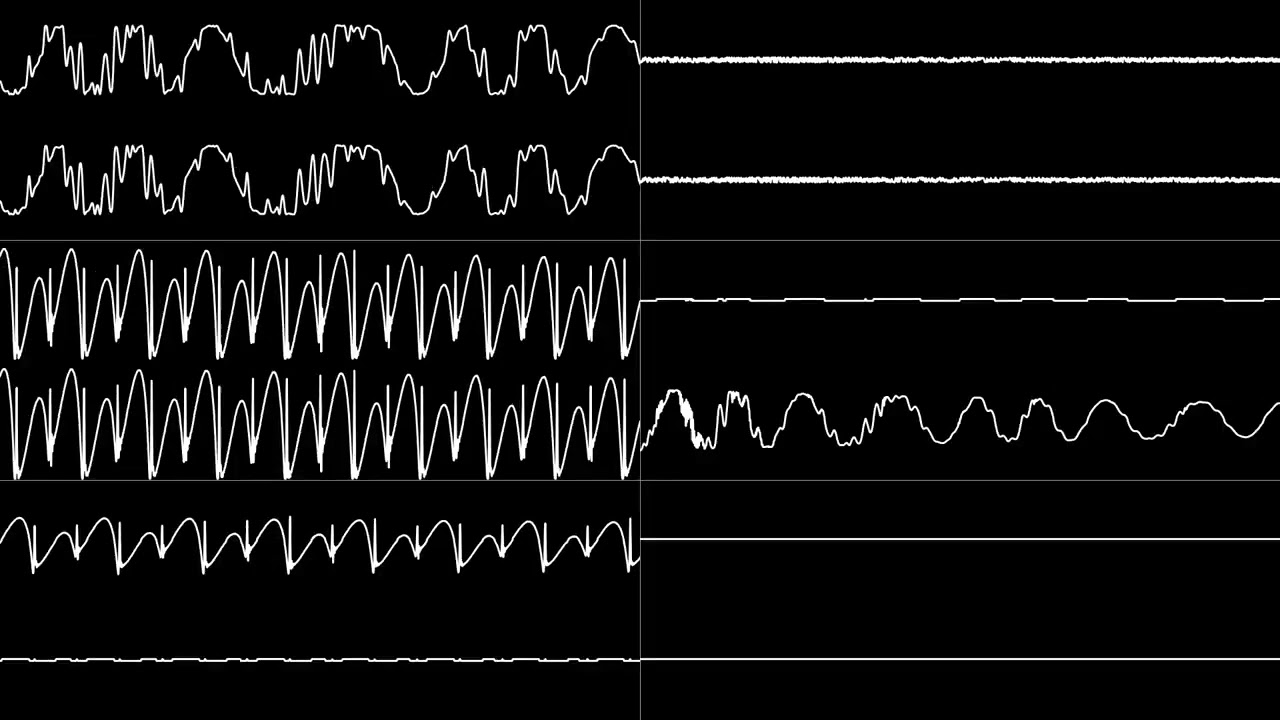 Matt Furniss   &ldquo;James Bond 007 : The Duel MD⧸Genesis&rdquo; Full Soundtrack Oscilloscope View (Reupload)