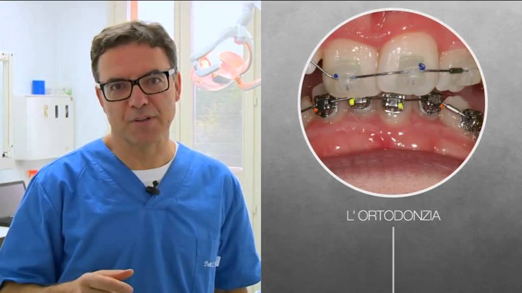 Ortodonzia | LCO - Le Cliniche Odontoiatriche