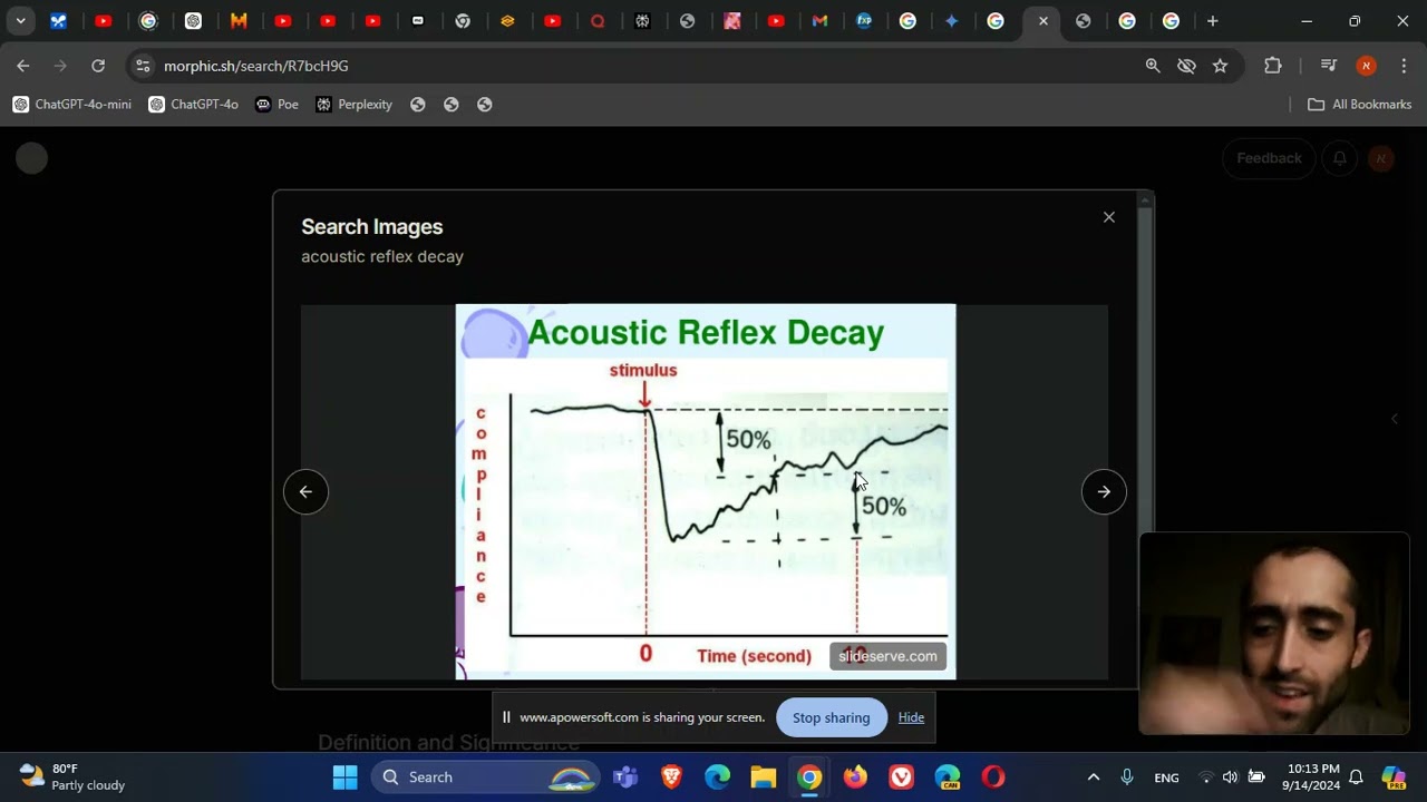 Otolaryngology   ENT   Audiology   Acoustic reflex decay