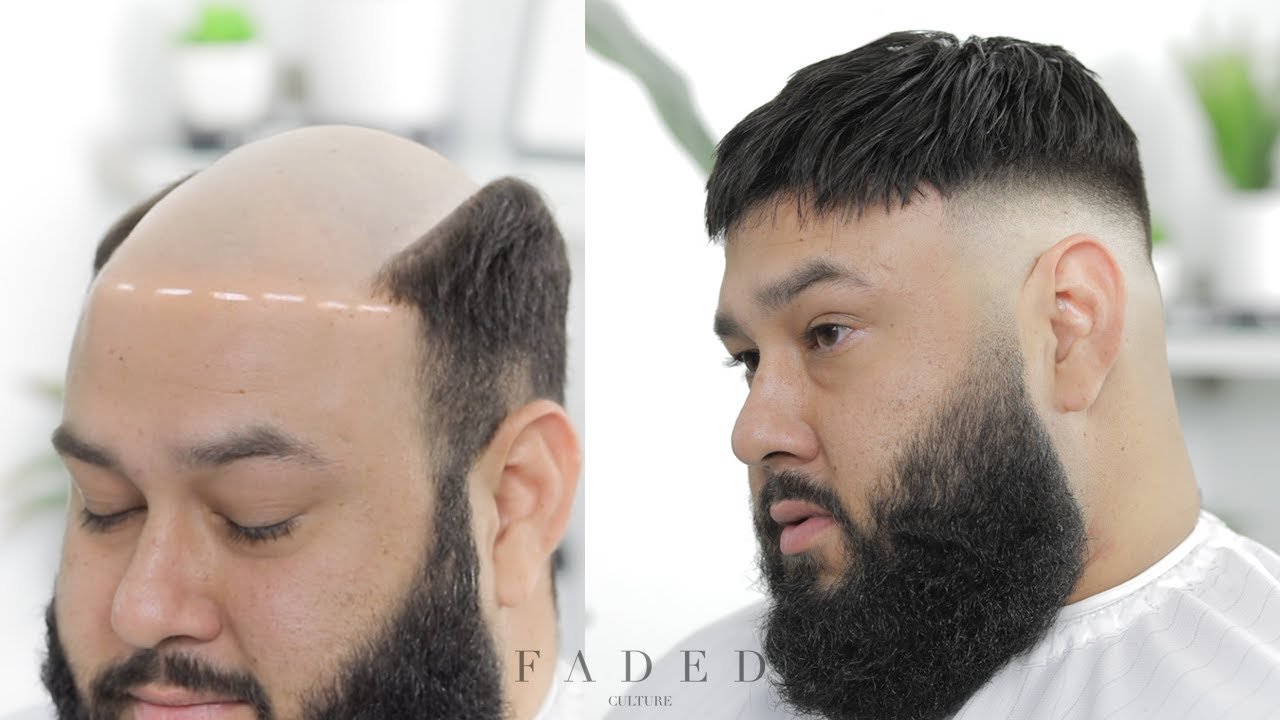 MENS WIG TUTORIAL (CRAZY HAIR LOSS TREATMENT)