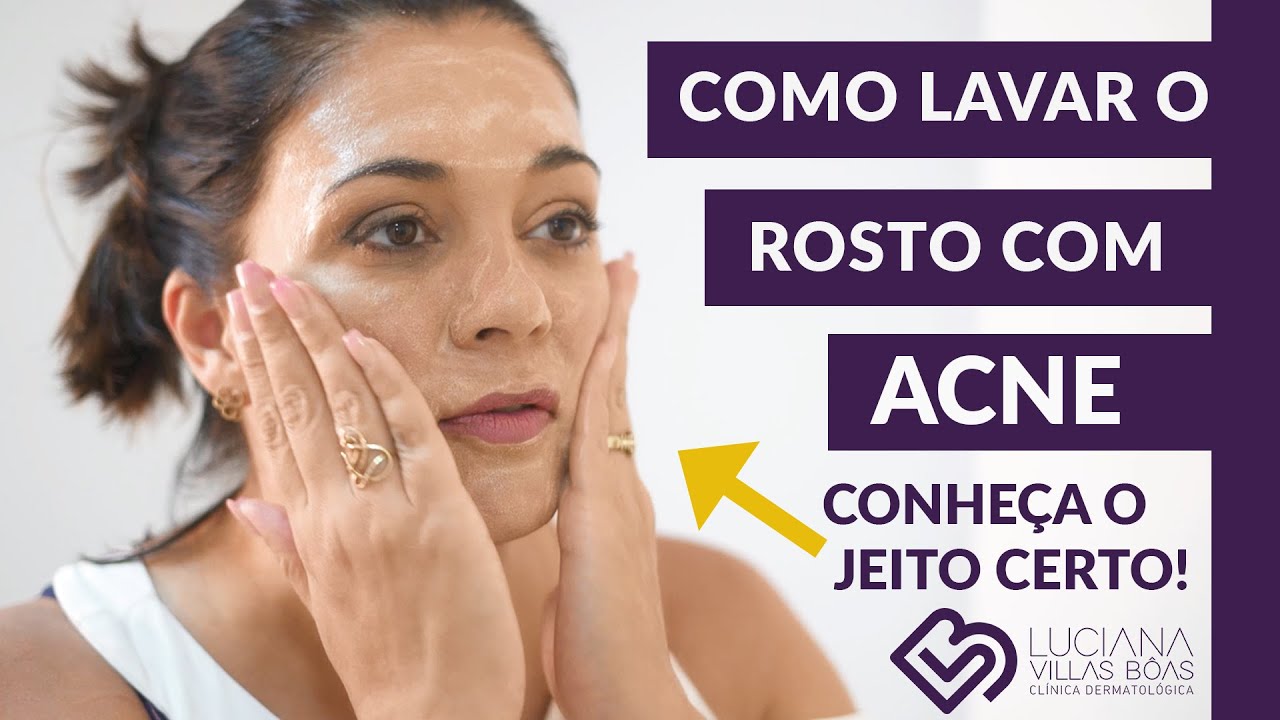 Como LAVAR o rosto com ACNE? Existe um jeito correto!