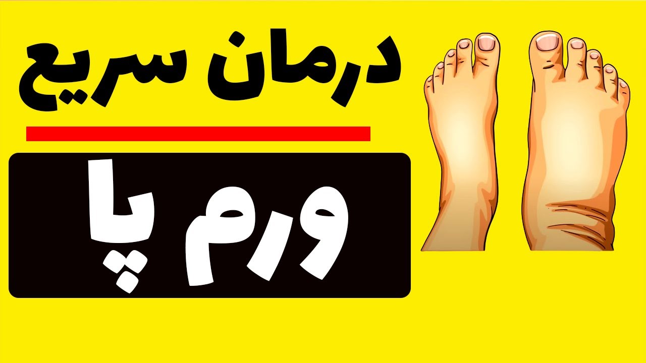 ورم پاهایت رو اینطوری درمان کن! | شش روش موثر برای درمان کاهش تورم پا و مچ پا که نمی دونستید| آدم پا
