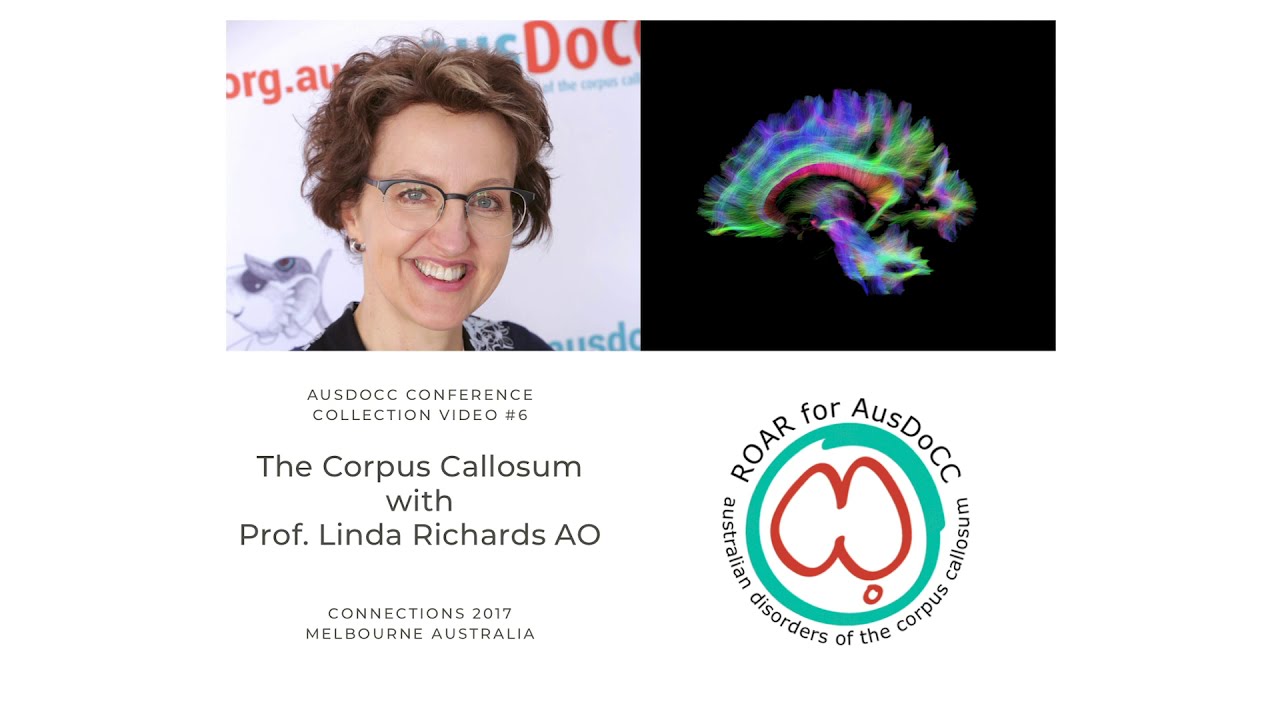 #6 The Corpus Callosum with Professor Linda Richards