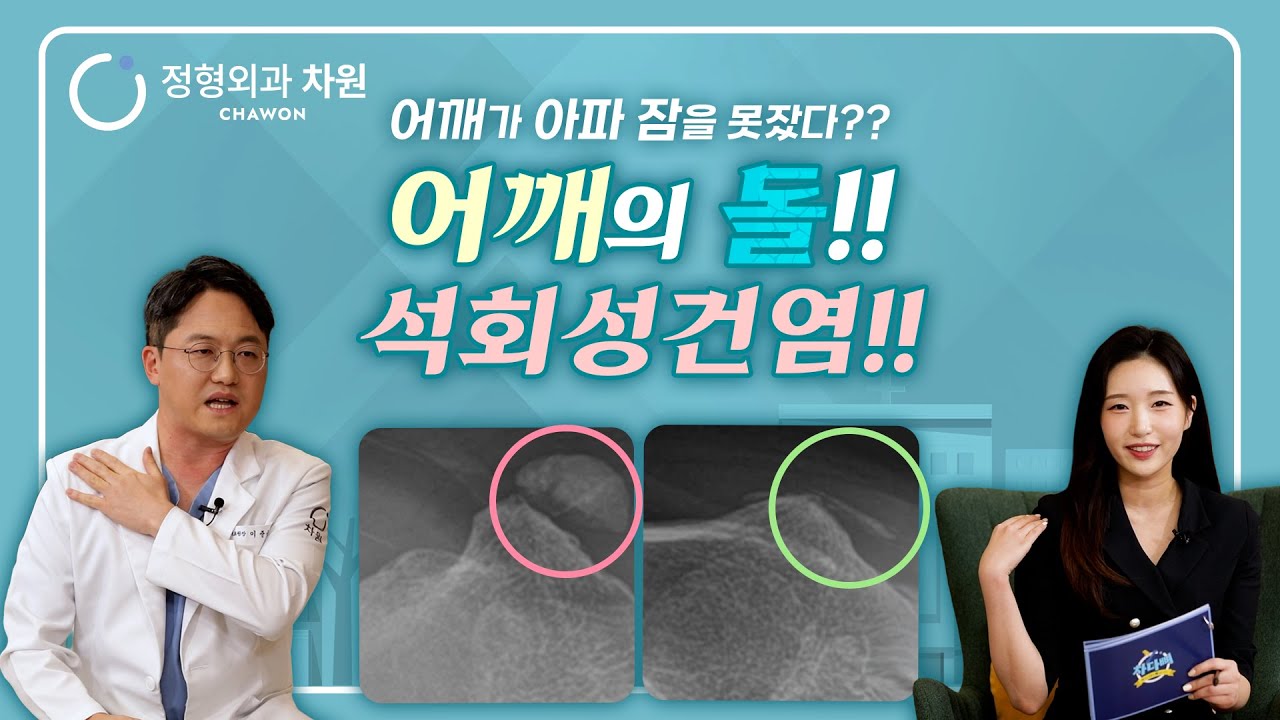 갑작스런 어깨 통증? 석회성건염의 원인과 치료법 완전 정복!