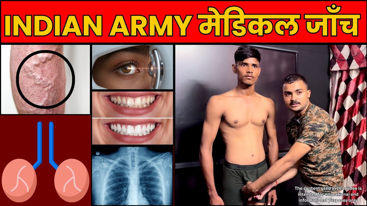 💥कृपया लड़कियां इस वीडियो से दूर रहे  | Army Agniveer Medical Checkup | Indian Army Medical Checkup