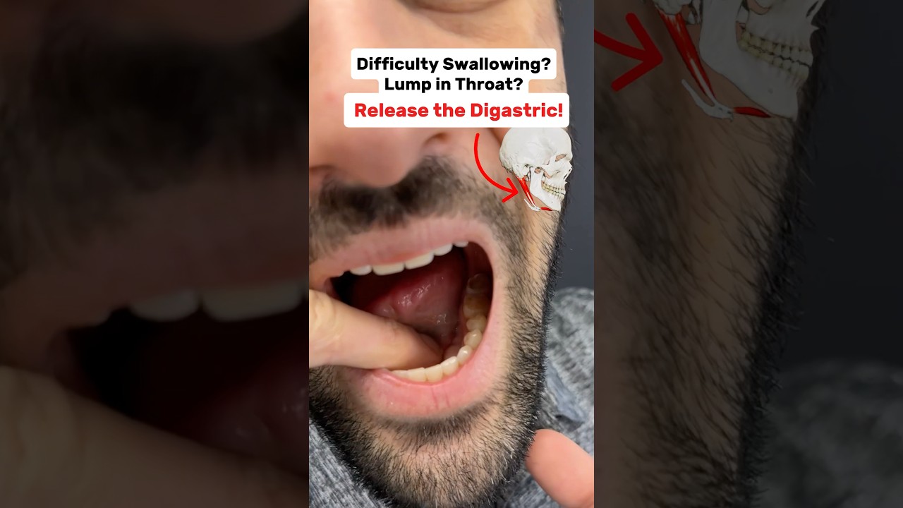 Difficulty swallowing? Lump in your throat? Try this digastric release for relief! #jawpain #tmj