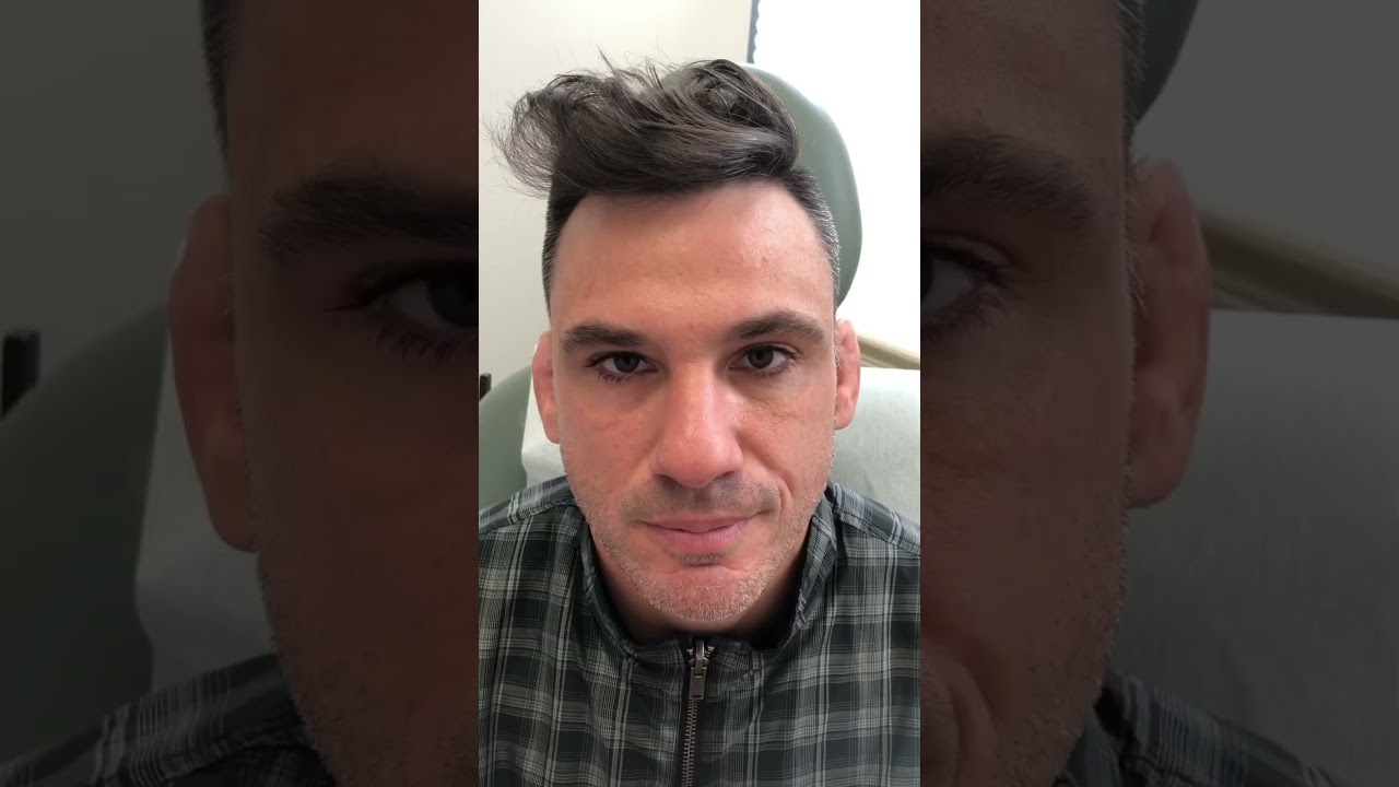 Before and After Male Botox / Dysport #botox #dysport #daxxify #cosmeticdermatology