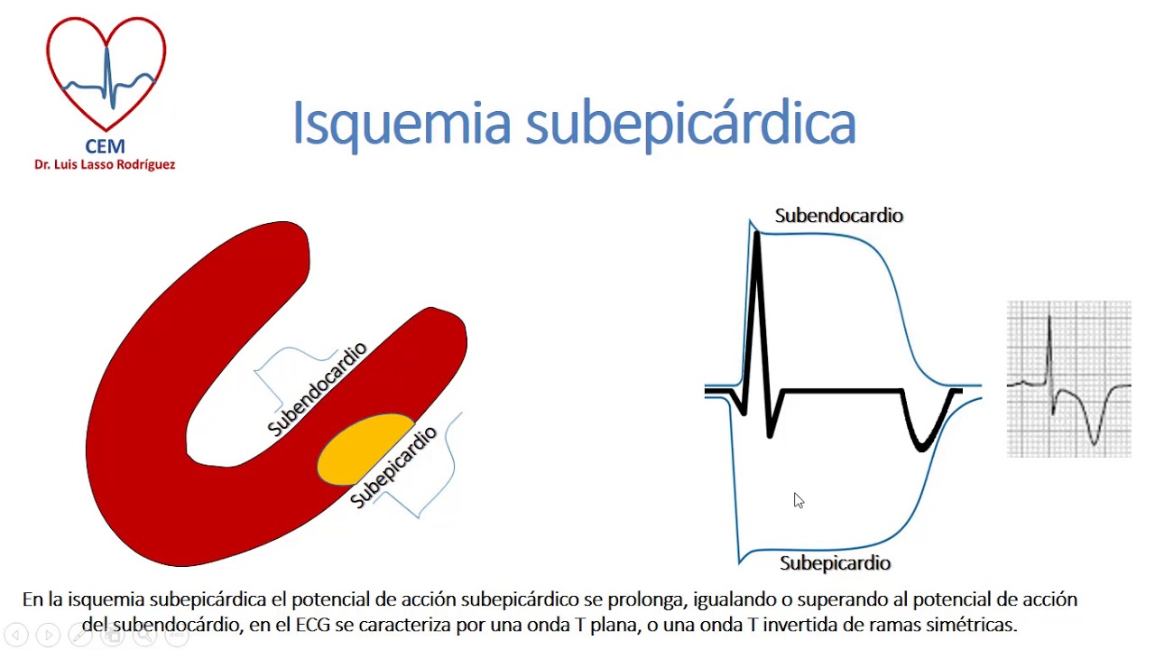 Isquemia, lesion y necrosis