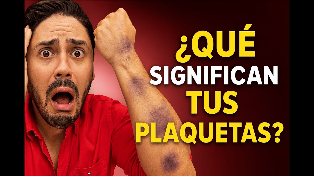 ¿MORETONES INEXPLICABLES? Esto Revelan tus PLAQUETAS (Altas o Bajas)