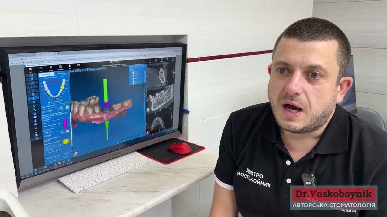 Нові можливості ортопедичного модулю CAD+ в програмі RealGUIDE 5.4.0
