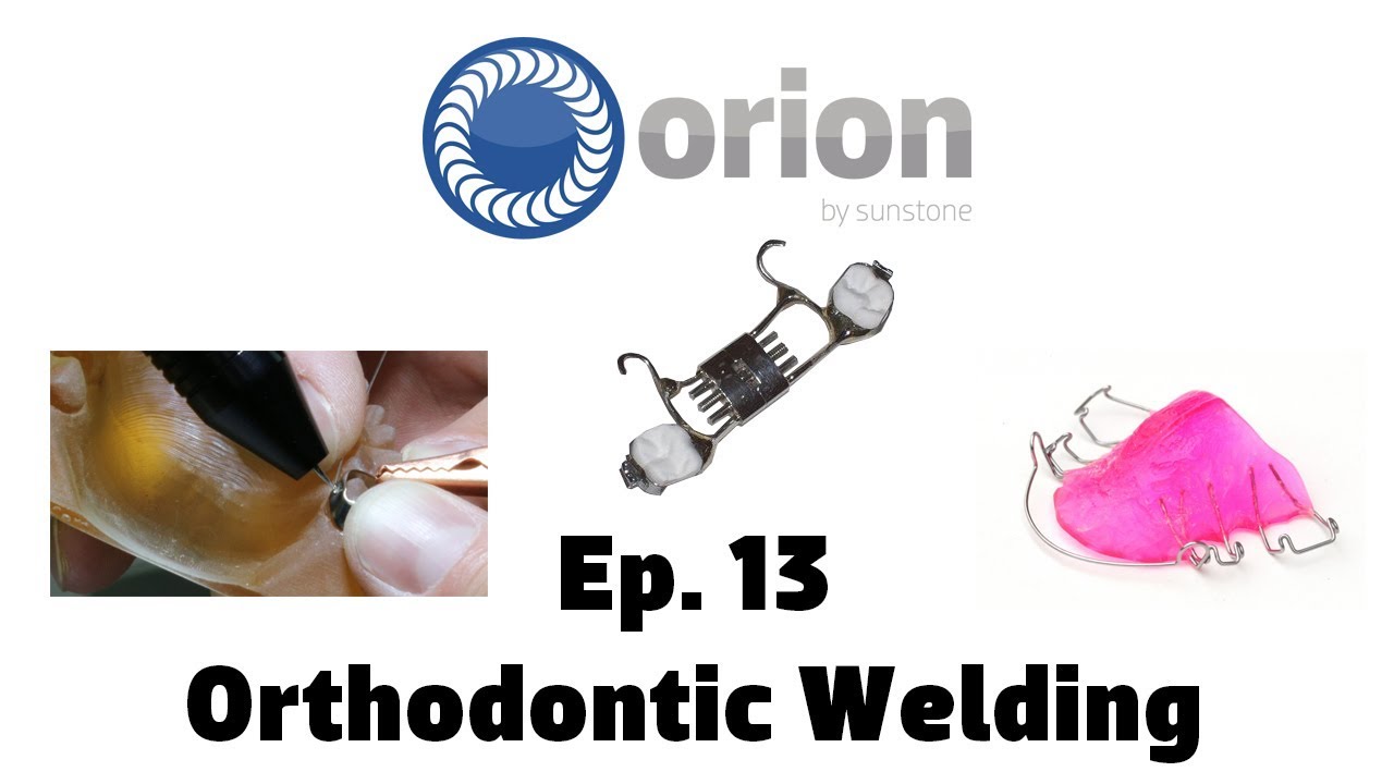 Ортодонтическая сварка &mdash; обучающий вебинар Orion &mdash; Эпизод 13