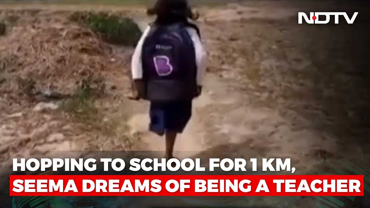 Bihar Girl Lost 1 Leg In Accident, Now Hops To School. Her Courage Wins Internet