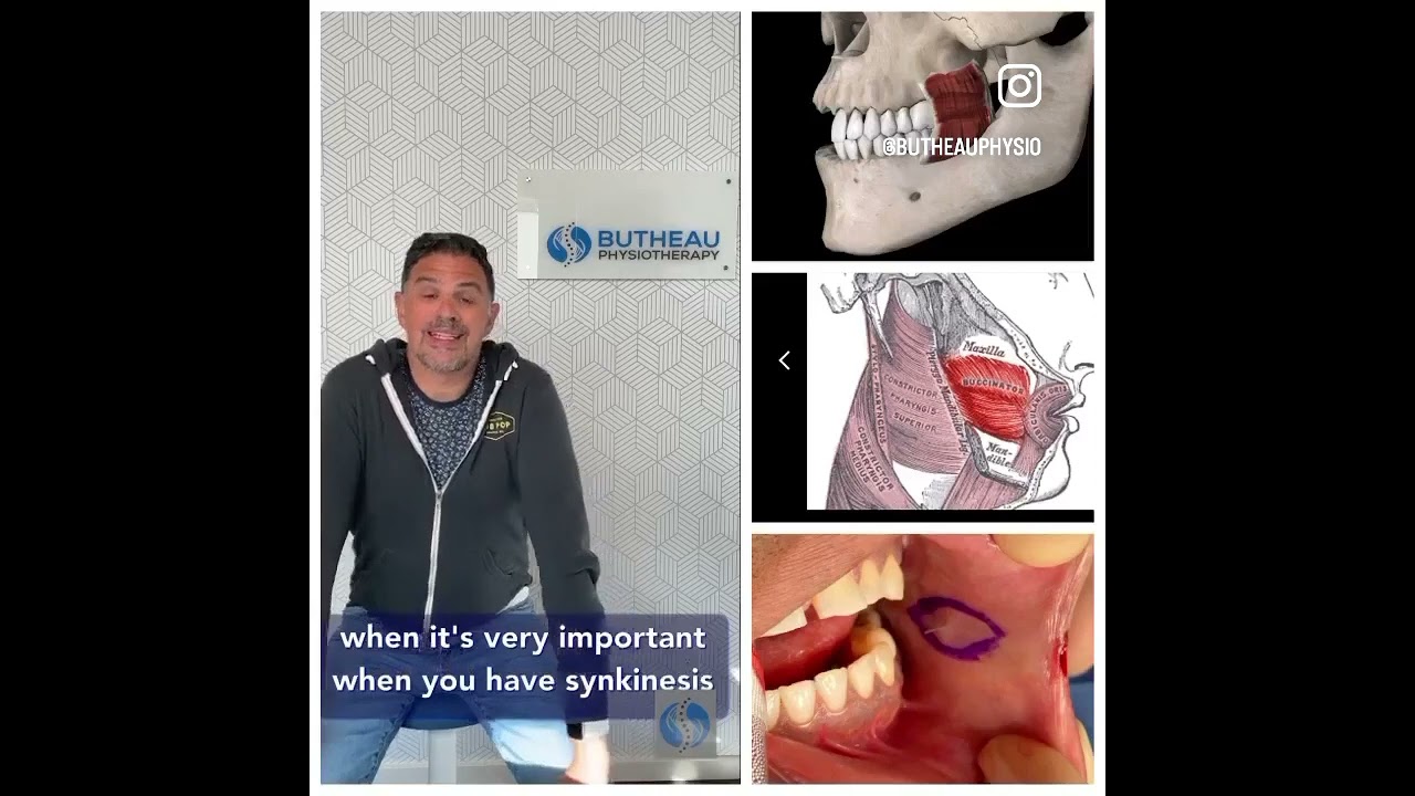 The Buccinator: One of the most important muscles to stretch with facial paralysis