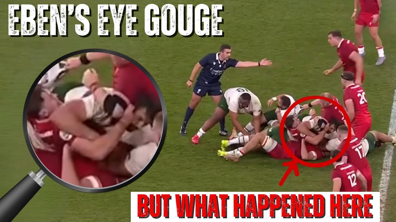 The Eben Etzebeth Eye Gouge
