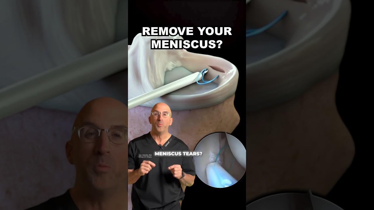 INSIDE the Knee 👀 Meniscus Removal #shorts