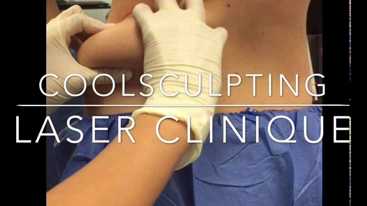COOLSCULPTING at Laser Cliniqúe