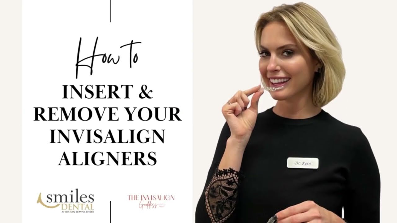 HOW TO INSERT & REMOVE YOUR INVISALIGN ALIGNERS | THE CORRECT WAY