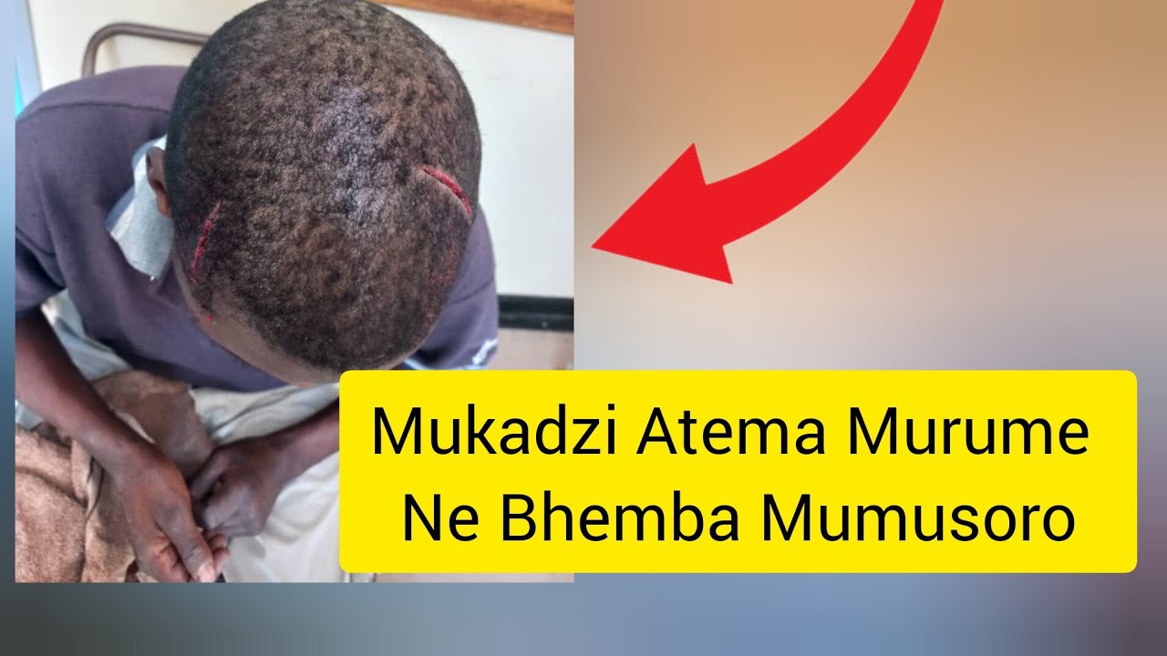 Mukadzi Atema Murume Nebhemba Mumusoro