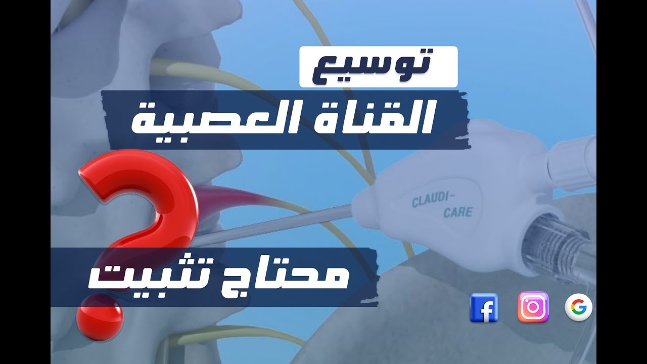 توسيع القناة العصبية 