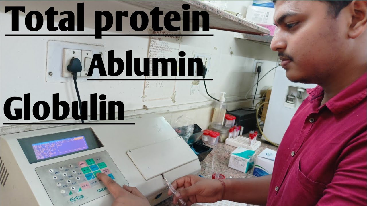 Total protein, Albumin, Globulin || liver function test || in semi automatic||