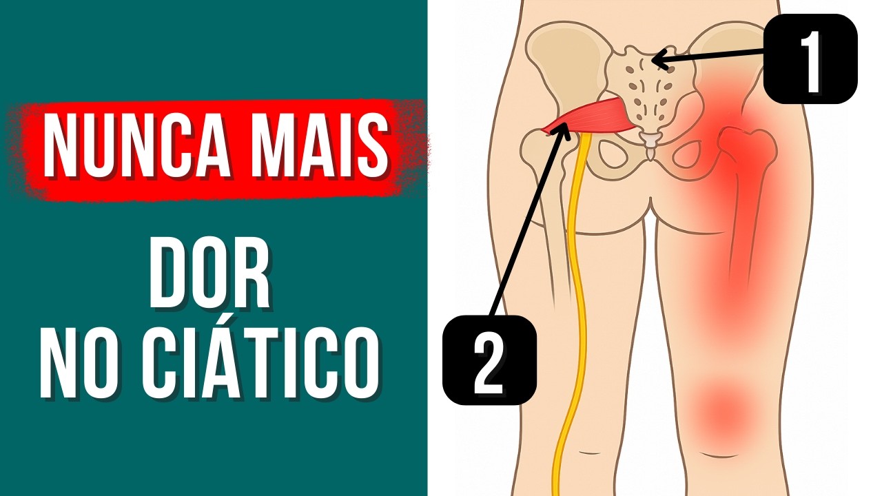 Cansou de Remédio? ALIVIE A DOR CIÁTICA com 2 Movimentos