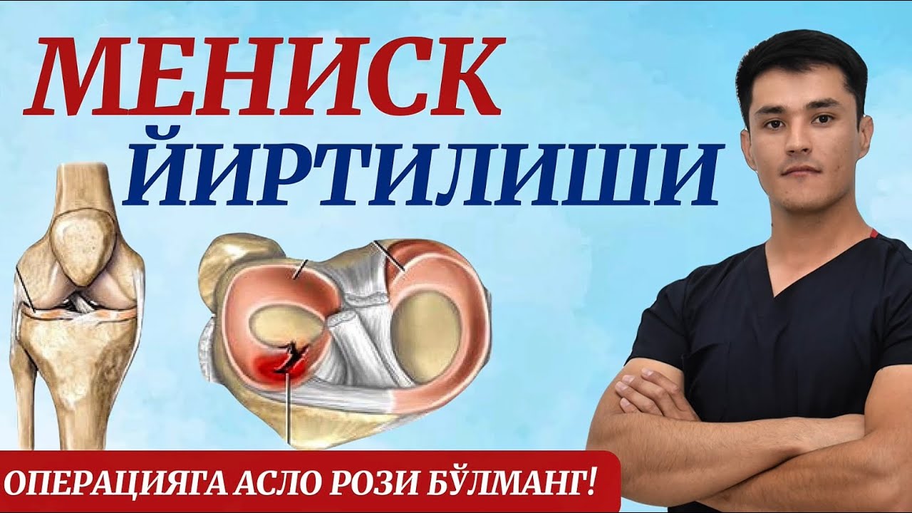 Тизза оғриқлари. Мениск йиртилишида операцияга асло рози бӯлманг.