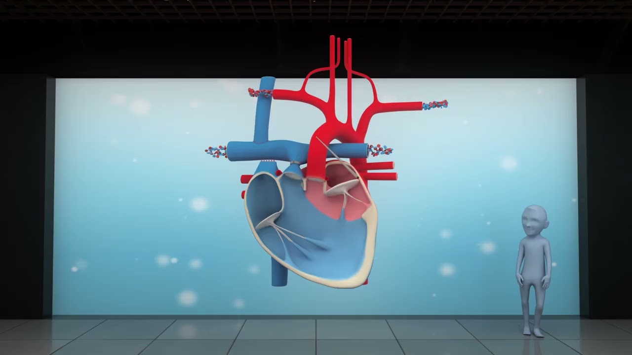 Bidirectional Cavopulmonary Connection (BCPC) & The Fontan Operation