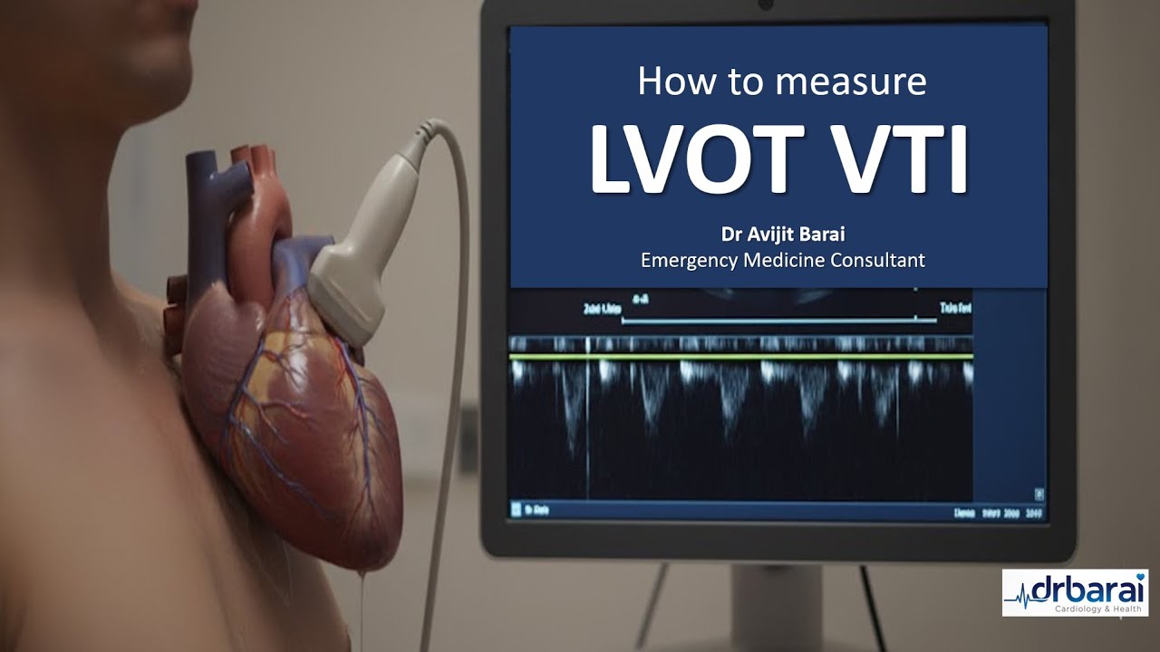 How to measure LVOT VTI  : A step-by-step approach you MUST know | Echocardiography | 2025