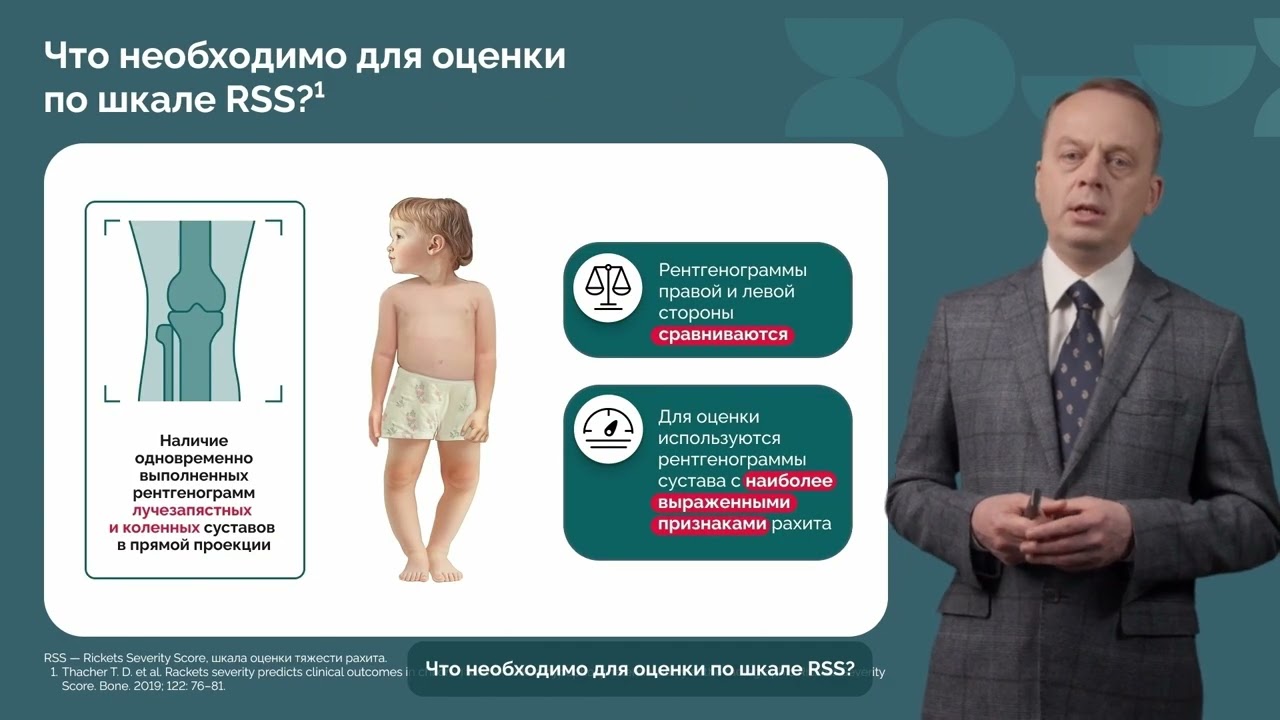 Рентгенологическая оценка тяжести проявлений рахита с помощью шкалы RSS (часть 1)