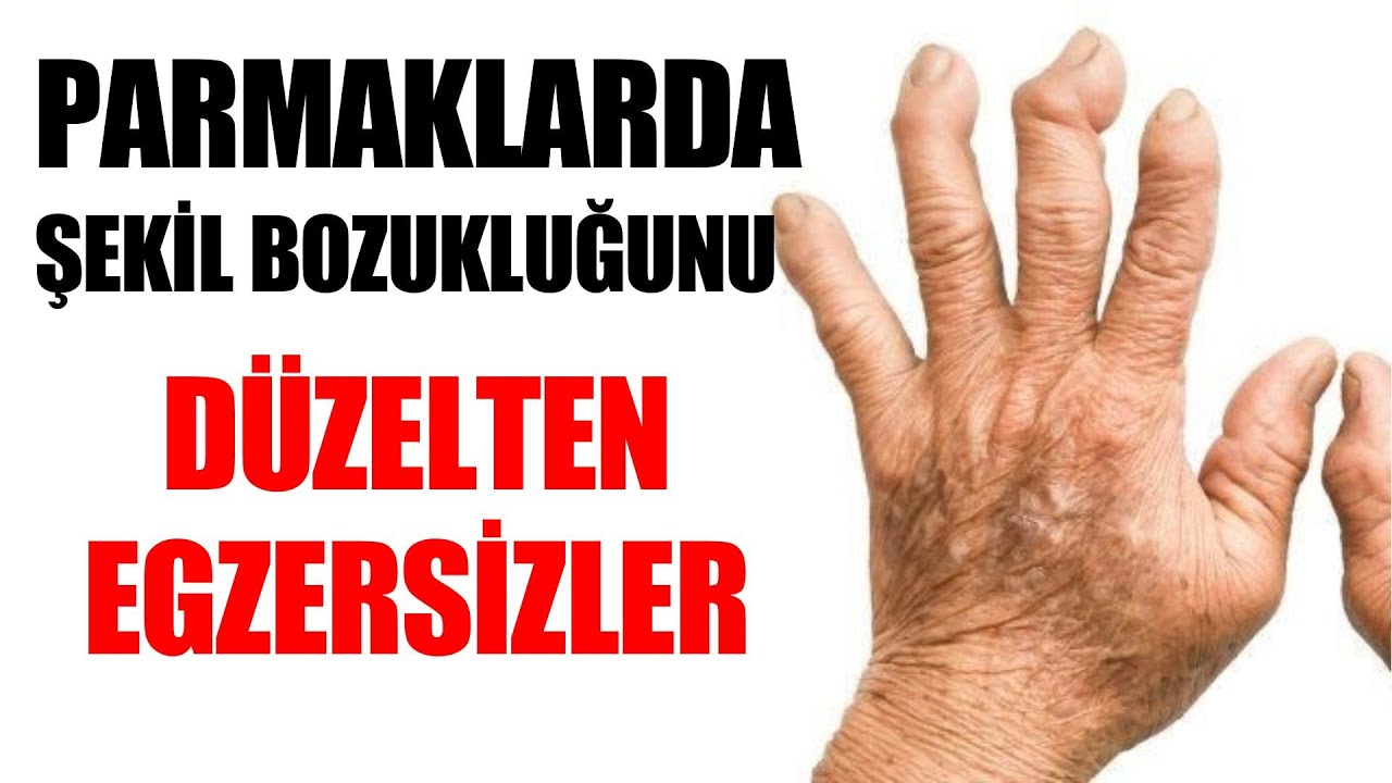 Ellerde Kireçlenme , Parmaklarda Kireçlenme , Fizyoterapist Aynur Baş #fizyolina #İstanbul