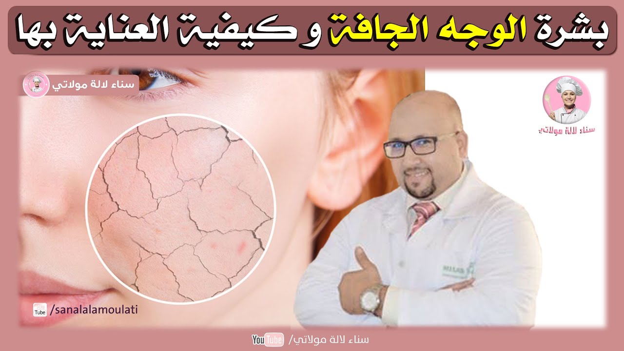 بشرة الوجه الجافة وكيفية العناية بها / وصفات الدكتور عماد ميزاب
