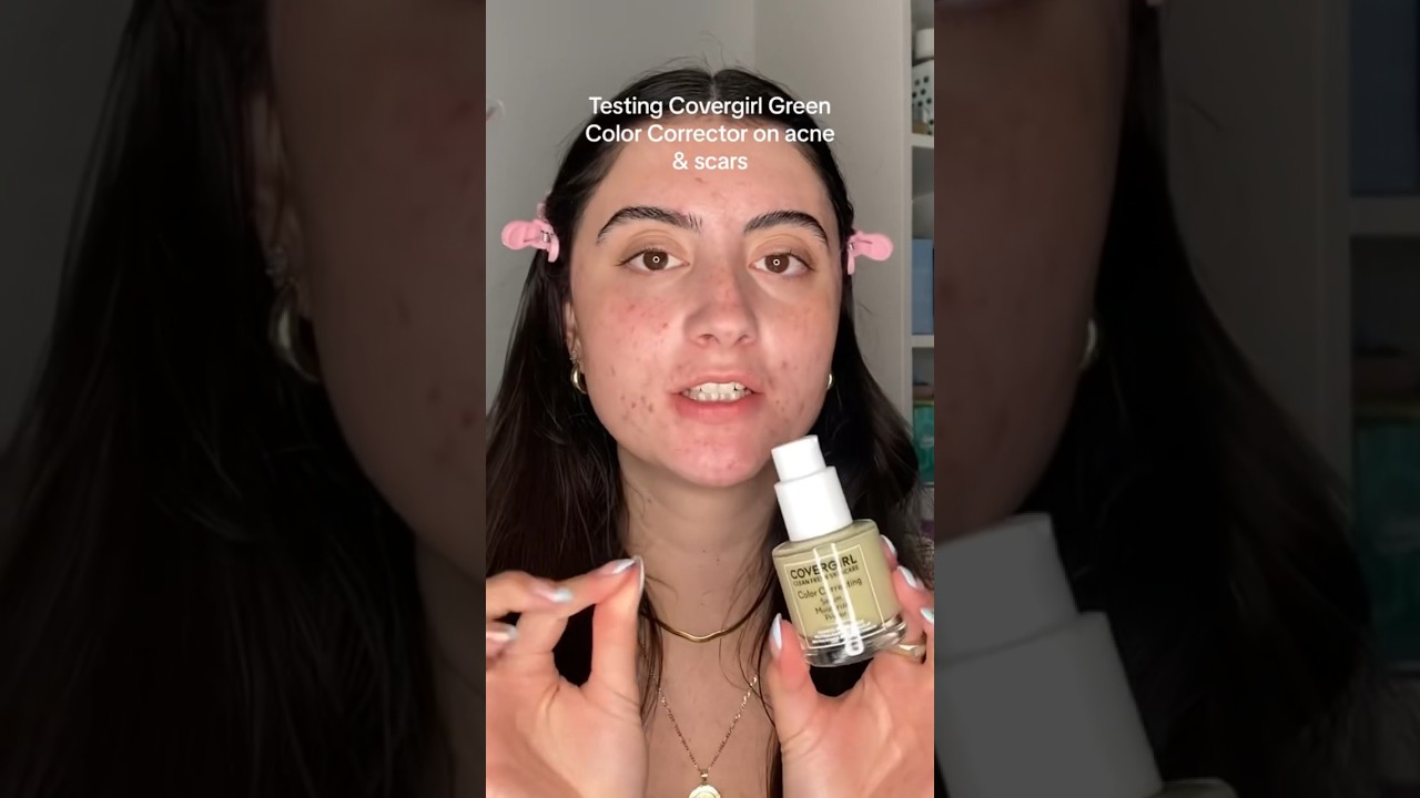 GREEN COLOR CORRECTING SERUM ON ACNE #beautytips #makeuptutorial #acnepositivity #acne