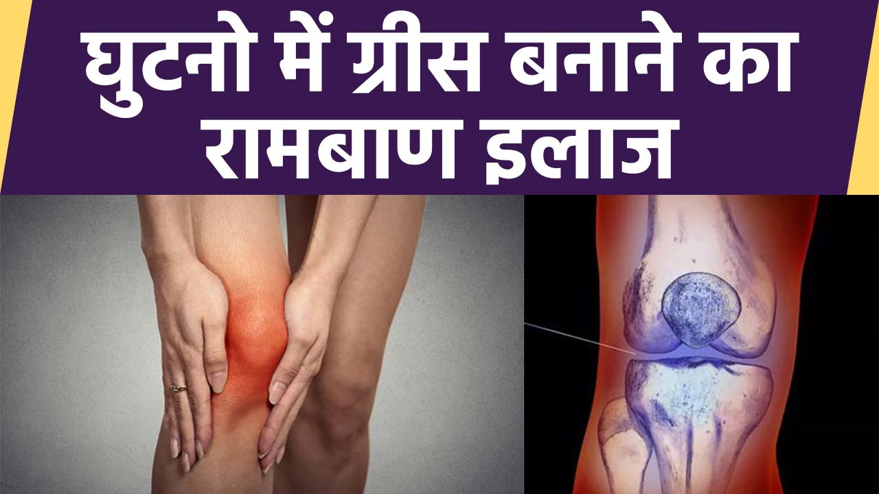 Knee Grease Problem का रामबाण इलाज,1 Month में दिखेगा फर्क|Boldsky