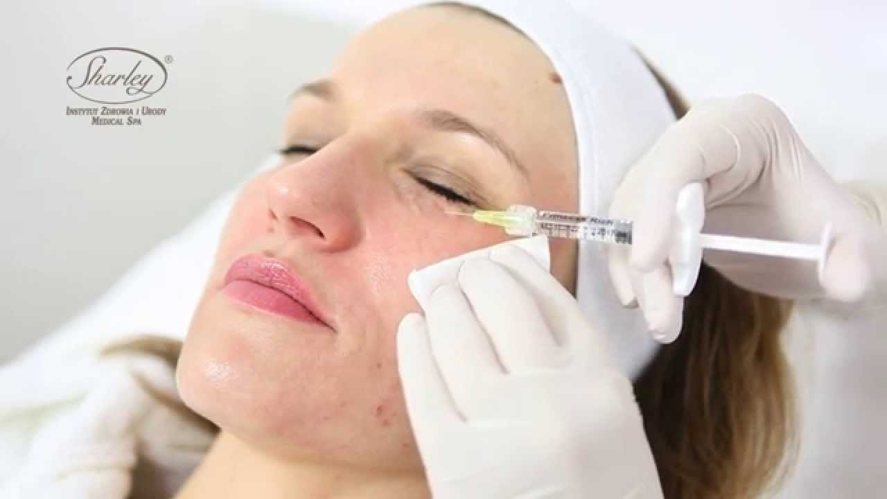 Medycyna estetyczna, Mezoterapia okolic oczu