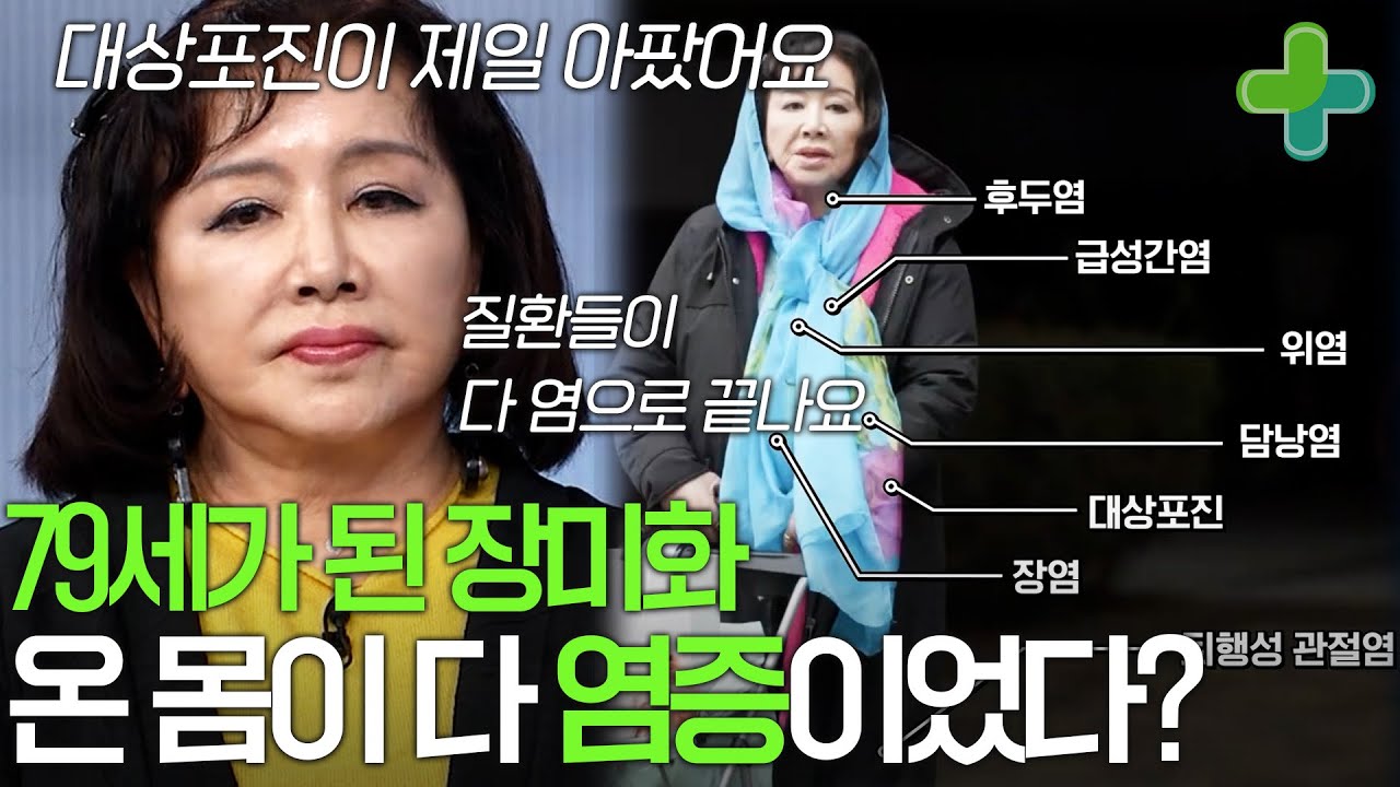 79세가 된 장미화, 활력 넘치는 일상 속에 사실 온 몸이 다 염증이었다