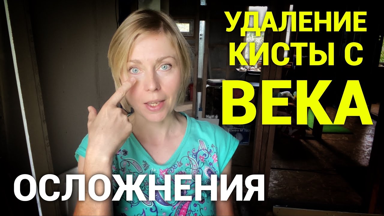 Моя киста Молля спустя пол года после операции. Осложнения. Просто дневник Константиновой.