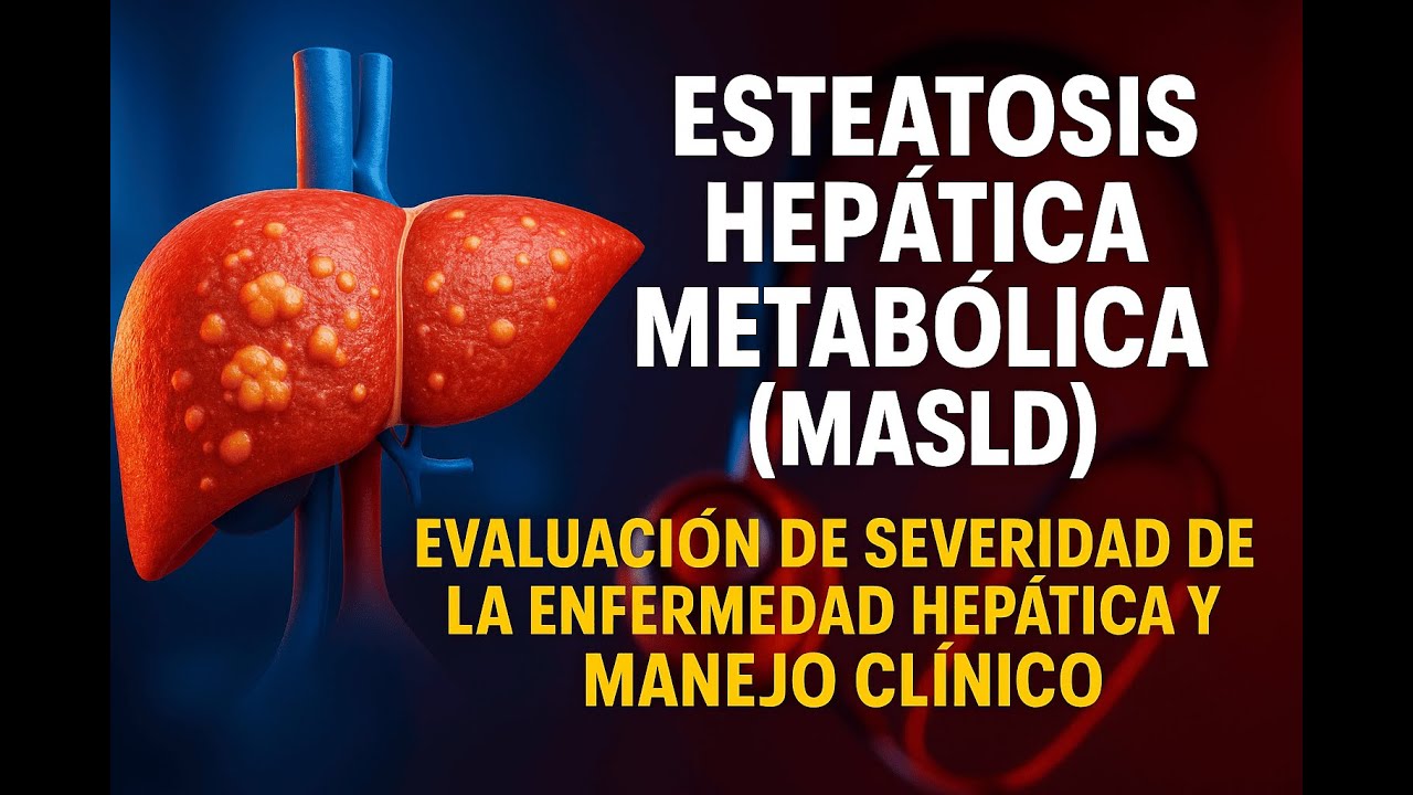 Estenosis hepática metabólica (MASLD)Evaluación severidad de la enfermedad hepática y manejo clínico