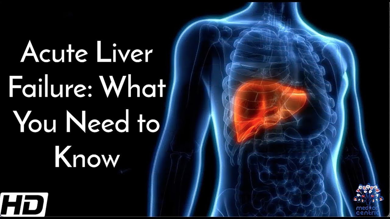 Acute Liver Failure: What You Need To Know
