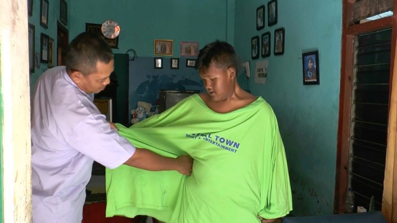 Fattest Indonesian Boy Loses 220lbs In Amazing Transformation