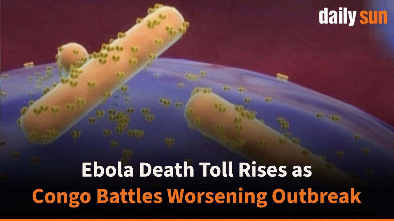 Ebola Outbreak Worsens in Congo, Death Toll Climbs to 82 | Daily Sun