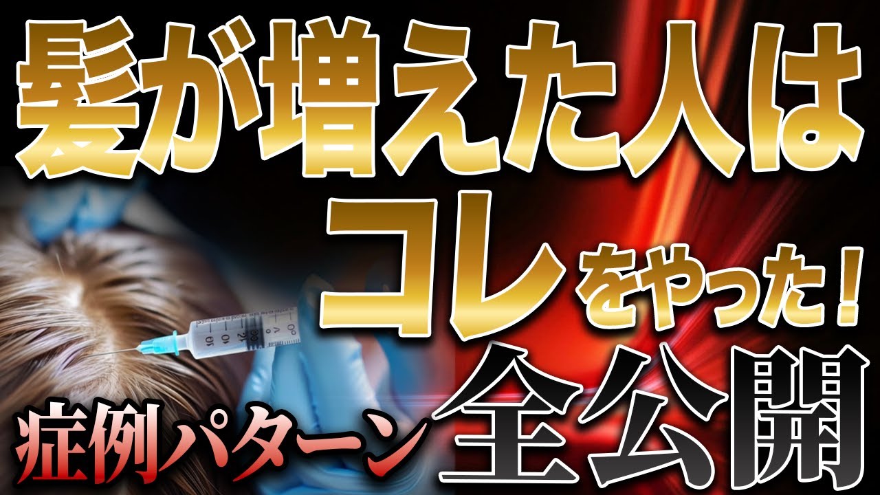 【薄毛治療】髪が増えた人はこれをやった！治療法を比較＆解説！