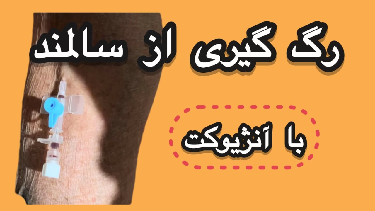 رگ گیری با آنژیوکت از سالمند و وصل کردن سرم🌍👑♾️