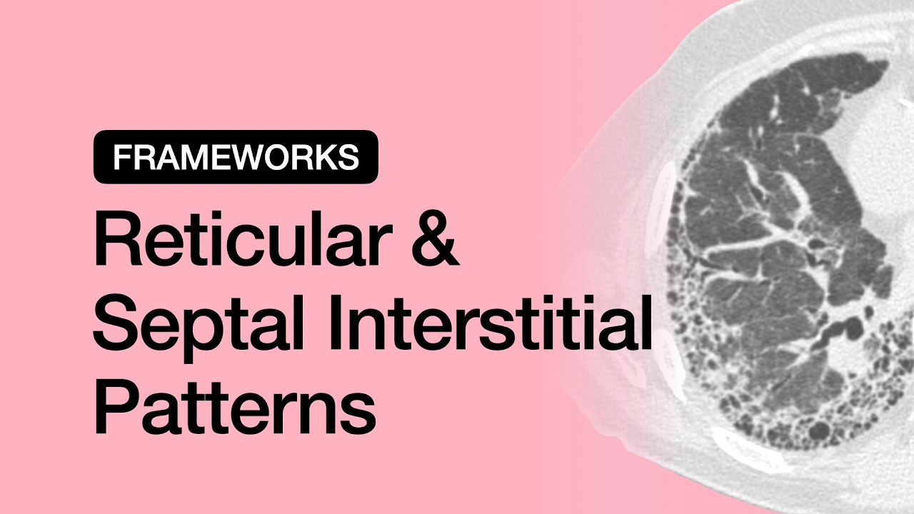 Reticular & Septal Interstitial Patterns | Chest Radiology Essentials