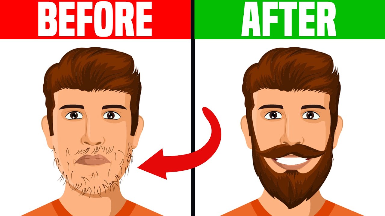 How to Deal With a Patchy Beard
