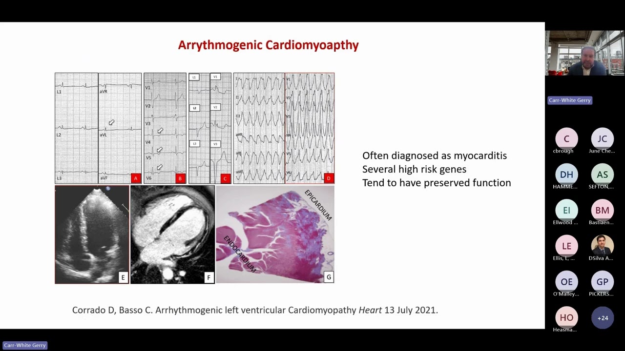 Rare disease notebook: Hidden in heart failure - Inherited cardiac conditions